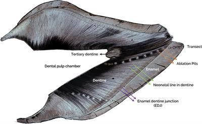 Use of zinc deposited in deciduous teeth as a retrospective measurement of dietary zinc exposure during early development